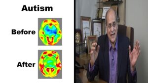 Dr Alok Sharma – Best Neurosurgeon – FREE Consultation on Autism