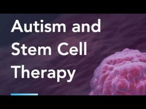 Stem Cell Therapy For Autism ||  Trending treatment